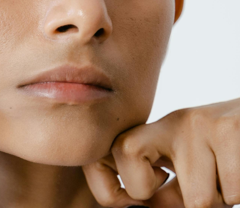 Temporomandibular Joint (TMJ) Syndrome